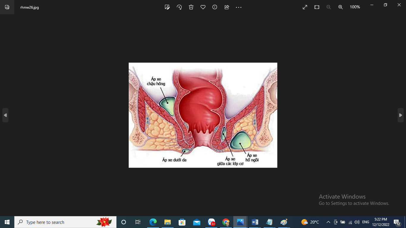 ĐỊA CHỈ CHỮA-TRĨ